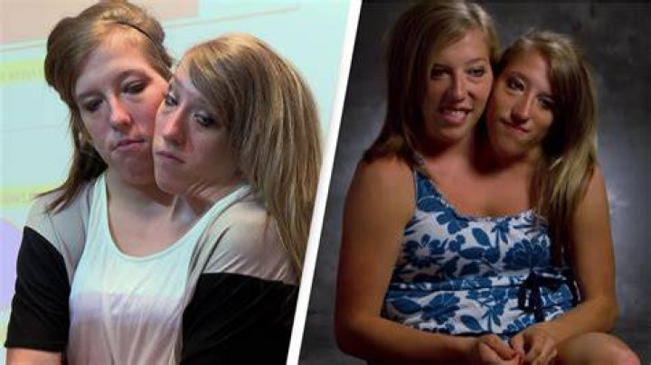 Abby And Brittany Hensel Finally Talks About Sex Life