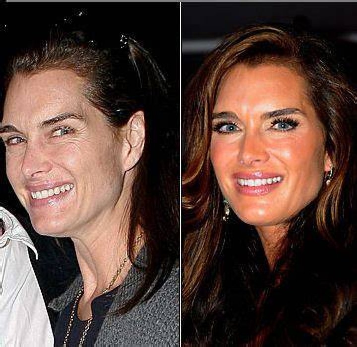 Brooke Shields Face Lift Did She Get Botox Or Her Nose Done?