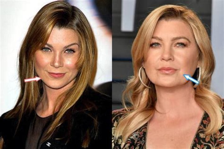 Did Ellen Pompeo Get Plastic Surgery? Transformation in Photos
