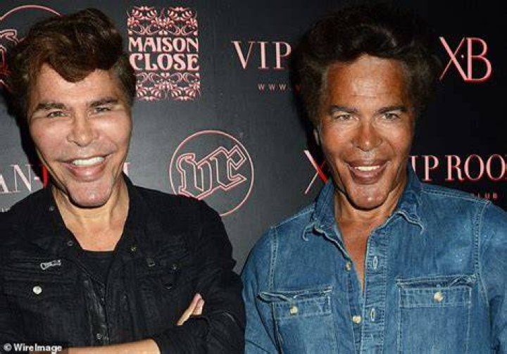 French TV star twins die with Covid just days apart