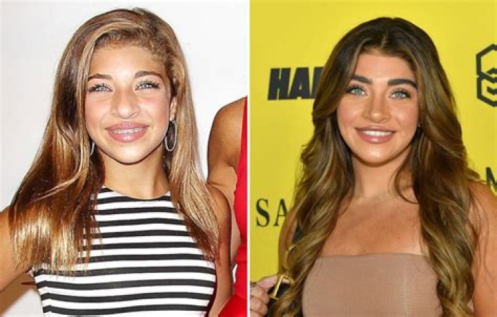 Gia Giudice Transformation Photos of the 'RHONJ' Star