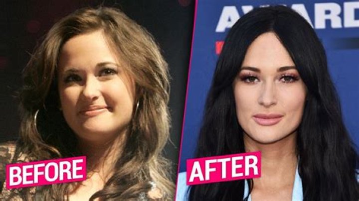 Kacey Musgraves Transformation, Plastic Surgery Speculation Life & Style
