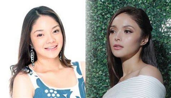 Kazel Kinouchi Before And After Plastic Surgery, Age Height