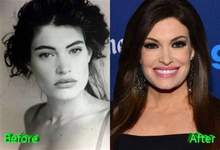 Kimberly Guilfoyle Plastic Surgery Kimberly Guilfoyle Face Before And