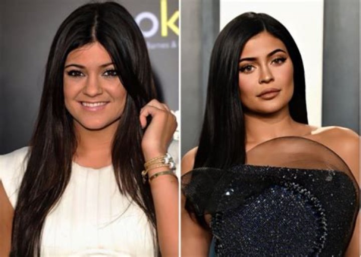 kylie jenner before and after Recherche Google Peinados f&aacute;ciles para cabello corto, Labios