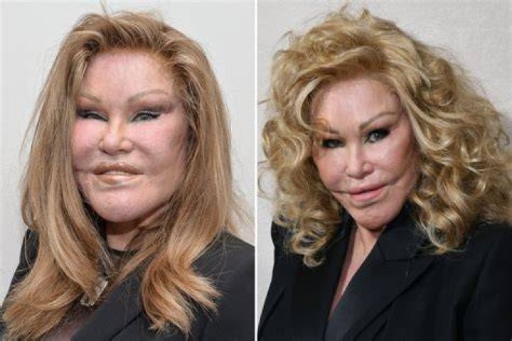 &lsquo;Catwoman&rsquo; Jocelyn Wildenstein Begs Friends to Help with Money