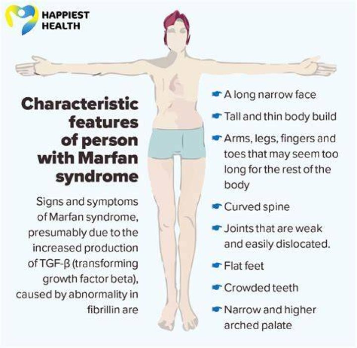 Marfan syndrome Cause and Diagnosis Happiest Health