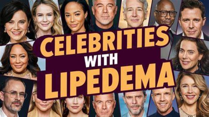 /ot/ Celebrities with lipedema