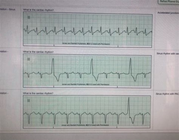 Solved Relias Phone ou tation Sinus What is the cardiac
