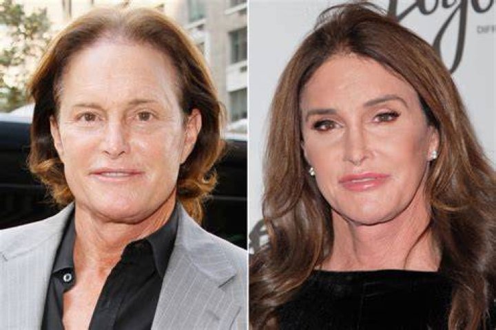 Unveiling The Truth: Caitlyn Jenner's Transgender Journey